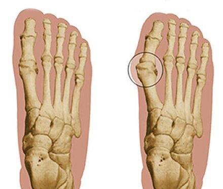 Foot development