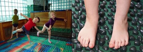Gymnastics to deform valgus